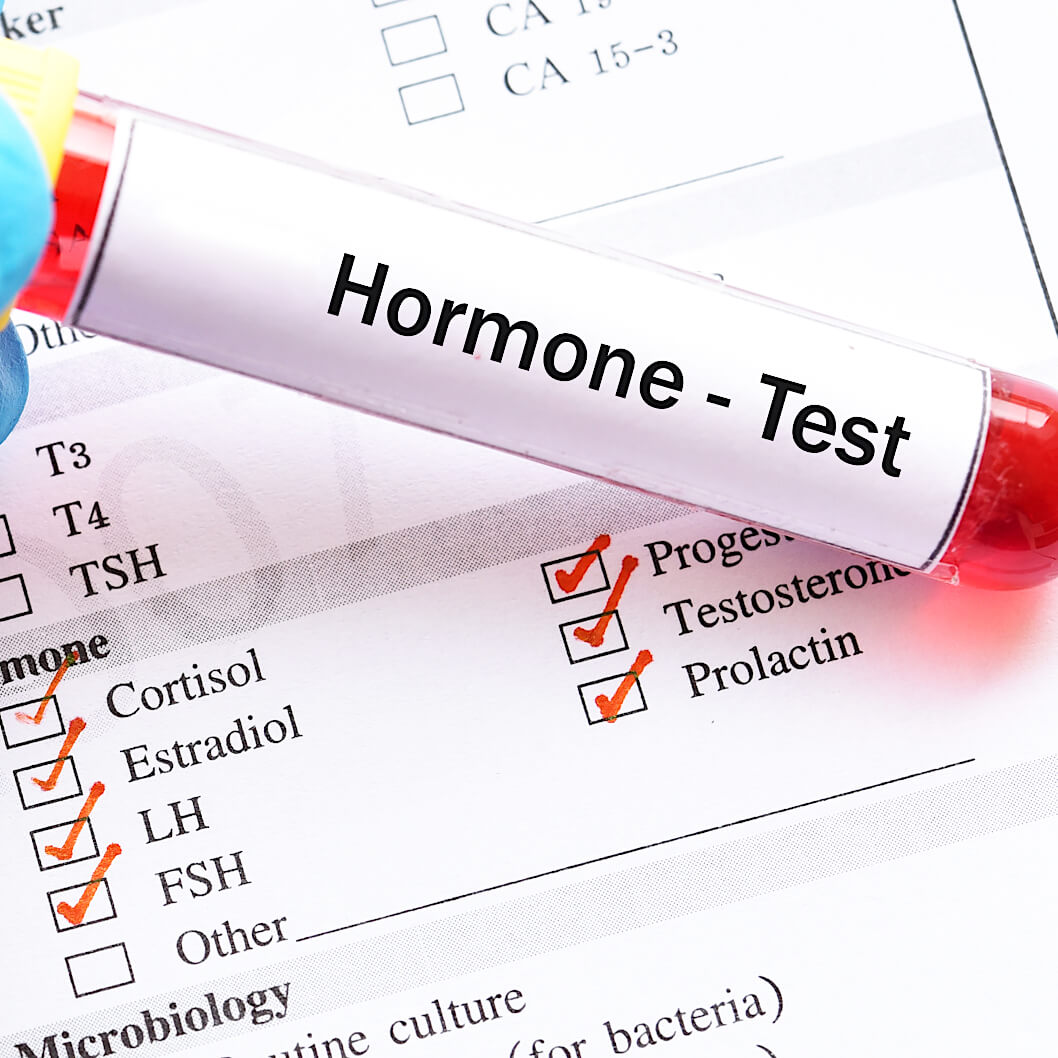Hormone test